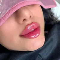 ژل بوتاکس عمل بینی ساکشن چربی در کلینیک بهنود