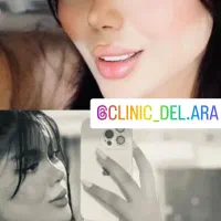 آف ویژه زیبایی بینی و لیپو ابدو|خدمات زیبایی و سلامت|اهواز, کیانپارس |دیوار