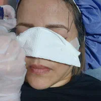ساکشن وتزریق چربی فیلروبوتاکس وپی ارپی سروصورت ونخ|خدمات آرایشگری و زیبایی|اندیشه, |دیوار
