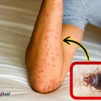 سم پاشی حشرات و موش و ..تضمینی و تخصصی|خدمات نظافت|کرمان, |دیوار