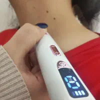 پاکسازی (فیشال) مراقبت های پوستی بهارستان|خدمات آرایشگری و زیبایی|اصفهان, بهارستان|دیوار
