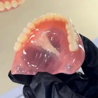 ساخت دندان مصنوعی ژاپنی ۲۵ میلیون تخفیف