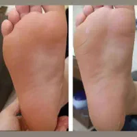 فشیال تخصصی صورت و بدن پارافین میکرونیدلینگ