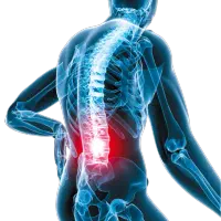 علت و درمان درد پایین کمر