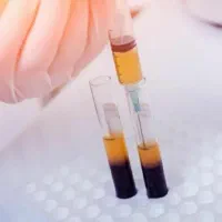 جشنواره prp و مزوتراپی ( آقایان و بانوان)