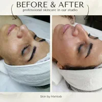 فیشال درمانی لوکس مدیکال گرید و شخصی‌سازی شده|خدمات آرایشگری و زیبایی|کرج, جهان‌شهر|دیوار