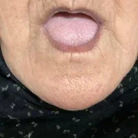 ساخت دندون مصنوعیی