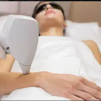 تخفیف ویژه لیزر موهای زائد کل بدن