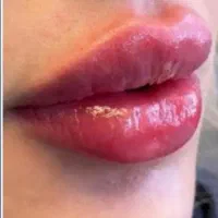 فرصت استثنایی زیبایی و لاغری، تخفیف به مدت محدود|خدمات آرایشگری و زیبایی|اهواز, کیانپارس |دیوار