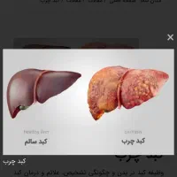 حجامت و طب سنتی در مطب پزشک|خدمات آرایشگری و زیبایی|اصفهان, مهدی آباد|دیوار