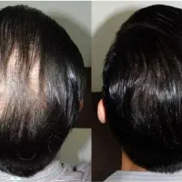 رویش دوباره از همین امروز