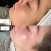 فیشیال با مواد درجه یک کابین|خدمات آرایشگری و زیبایی|تهران, شهرآرا|دیوار