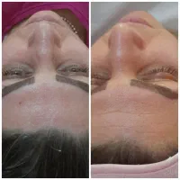 خدمات تخصصی پاکسازی و فیشیال پوست|خدمات آرایشگری و زیبایی|کرج, آق تپه|دیوار