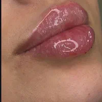 مرکز تخصصی افرینش لب روسی مادلینگ صورت بوتاکس و..|خدمات آرایشگری و زیبایی|اندیشه, |دیوار