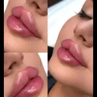 ژل فیلرلب چونه گونه اف ویژه نورامیس کاملا تخصصی|خدمات آرایشگری و زیبایی|زاهدان, |دیوار