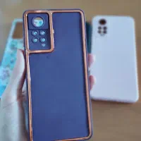 کاور گوشی نوت ۱۱ پرو|لوازم جانبی موبایل و تبلت|لردگان, |دیوار