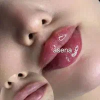 لیزر موهای زائد تضمینی