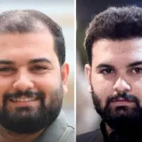 کاشت مو و ابروی طبیعی مزو و پی آرپی جلوگیری ریش مو|خدمات آرایشگری و زیبایی|تبریز, |دیوار