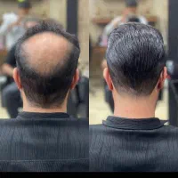 پروتز تخصصی مو ، فر شش ماه|خدمات آرایشگری و زیبایی|قم, بنیاد|دیوار