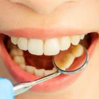 نیازمند دندان پزشک در سلمان شهر