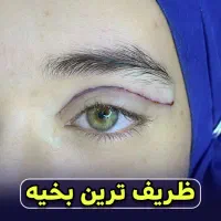 رفع سینه آقایان(ژنیکوماستی) بلفاروپلاسی ساکشن غبغب