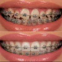 دندانپزشکی مرکز تخصصی ارتودنسی باشرایط فوق العاده|خدمات زیبایی و سلامت|شیراز, عفیفآباد|دیوار