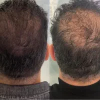 تونیک مو قطع ریزش رشد قوی رفع شوره وزی مو|آرایشی، بهداشتی، درمانی|آبادان, |دیوار
