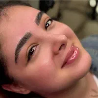 میکروبلیدینگ   ۱/۲۰۰به مدت یک هفته