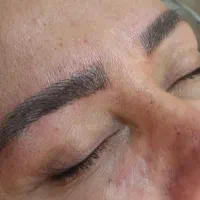 میکروبلیدینگ