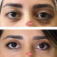 انواع جراحی های زیبایی با قیمت استثنایی