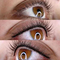 بن مژه تضمینی