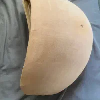 پروتز شکم بارداری