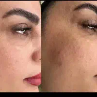 کرم معجزه گر|آرایشی، بهداشتی، درمانی|جیرفت, |دیوار