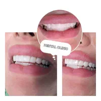 خدمات دندانپزشکی درمانی و زیبایی(ویزیت رایگان)