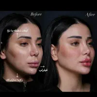 مطب زیبایی تپش .جشنواره تخفیف/لیزر/ژل بوتاکس|خدمات آرایشگری و زیبایی|گلبهار, شهر جدید گلبهار|دیوار