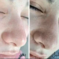 پاکسازی صورت