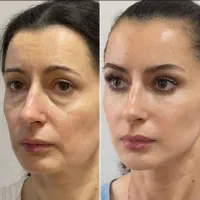 تا عید صورتتو ۲۰ سال جوون تر کن