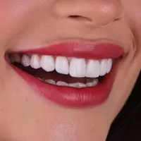 دیگر نگران هزینه‌های سنگین خدمات دندانپزشکی نباشید|خدمات آرایشگری و زیبایی|شیراز, ملاصدرا|دیوار