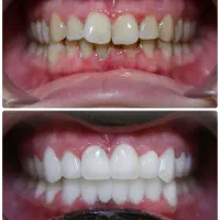 شرایط ویژه کامپوزیت و ارتودنسی تخصصی