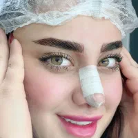 فیبروز شیدینگ میکرو ندا بهبهانی