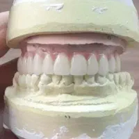 دندانسازی تاکستان|پزشکی|تاکستان, |دیوار