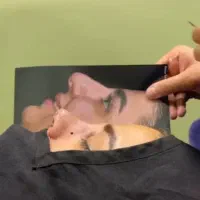 قسطی جراحی بینی و پیکرتراشی و لیفت صورت و ژل|خدمات آرایشگری و زیبایی|تبریز, |دیوار