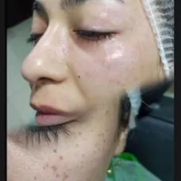 ازبین بردن کک ومک تضمینی در یک جلسه