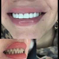 دندانپزشکی|خدمات آرایشگری و زیبایی|بروجرد, |دیوار