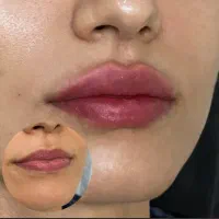 هدیه روز مادر آف ژل وبوتاکس|خدمات آرایشگری و زیبایی|ایذه, |دیوار