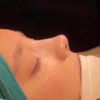 عمل جراحی زیبایی بینی،پلک،لیفت صورت