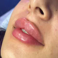اپراتور لیزر و کیوسوئیچ|استخدام درمانی، زیبایی، بهداشتی|کرج, گلشهر|دیوار