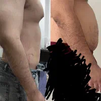 تزریق چربی و فیلربیکینی بانوان و آقایان/ساکشن چربی|خدمات آرایشگری و زیبایی|سقز, |دیوار
