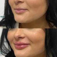 کلینیک تخصصی ژل و فیلر،لیپو و..