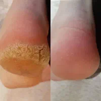 کفسابی/ پدیکور / + هدیه خفن|خدمات آرایشگری و زیبایی|اندیشه, اندیشه فاز ۱|دیوار